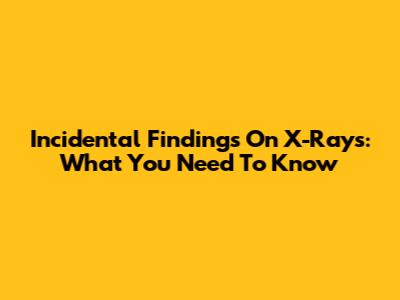 Incidental Findings On X-Rays: What You Need To Know