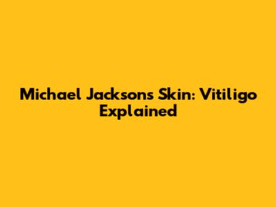 Michael Jackson's Skin: Vitiligo Explained