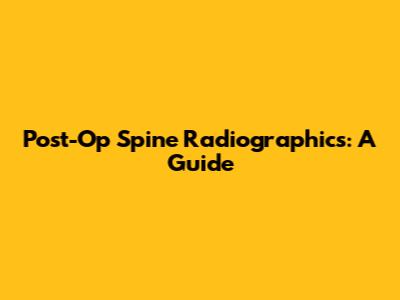 Post-Op Spine Radiographics: A Guide